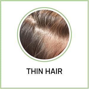 thin hair