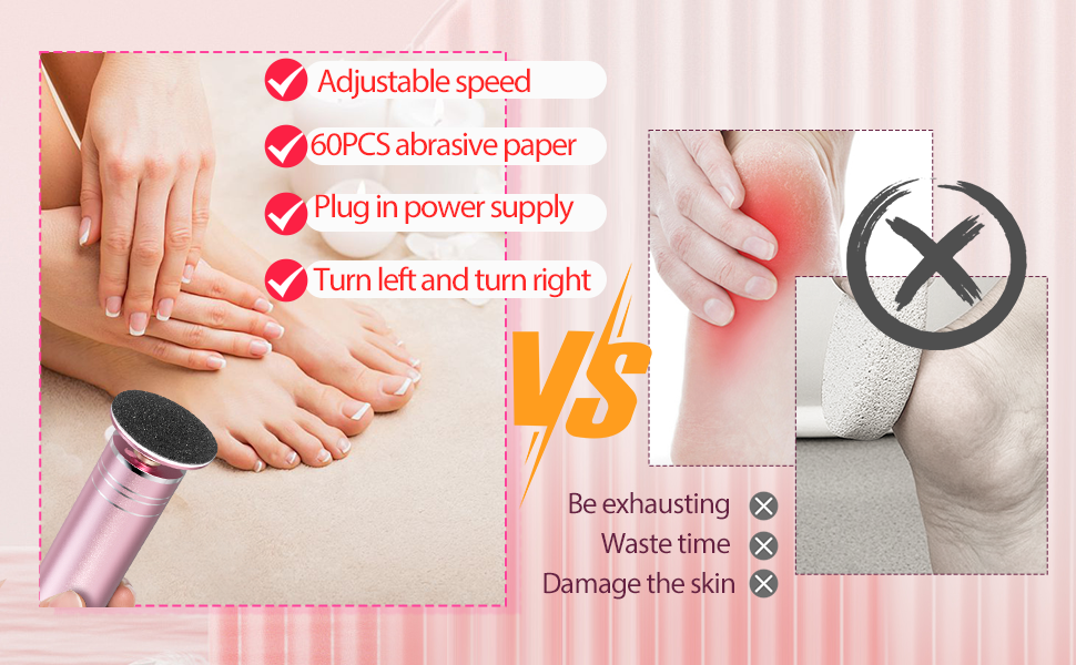 electric callus remover