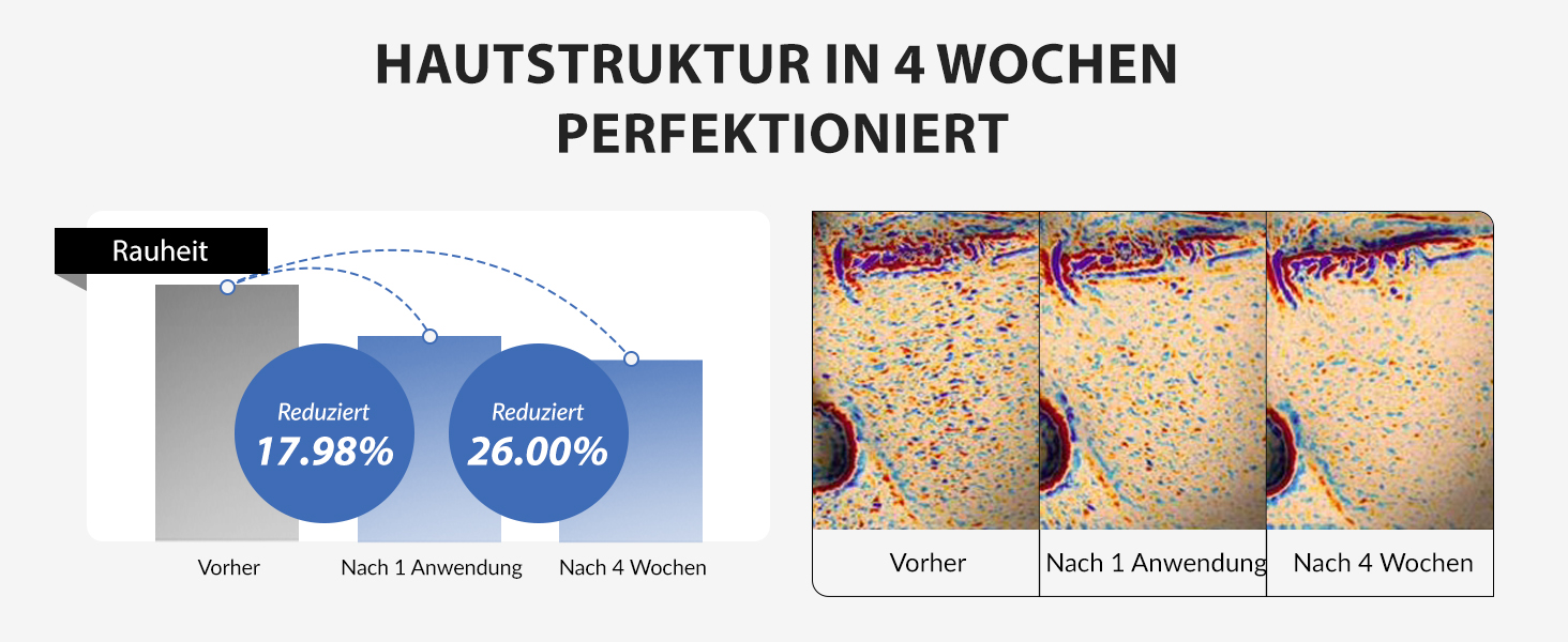 17bdf511 50c8 46a1 A770 52220322b80d. CR0,0,1464,600 PT0 SX1464 V1