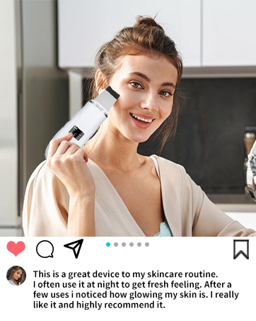 black head remover for face