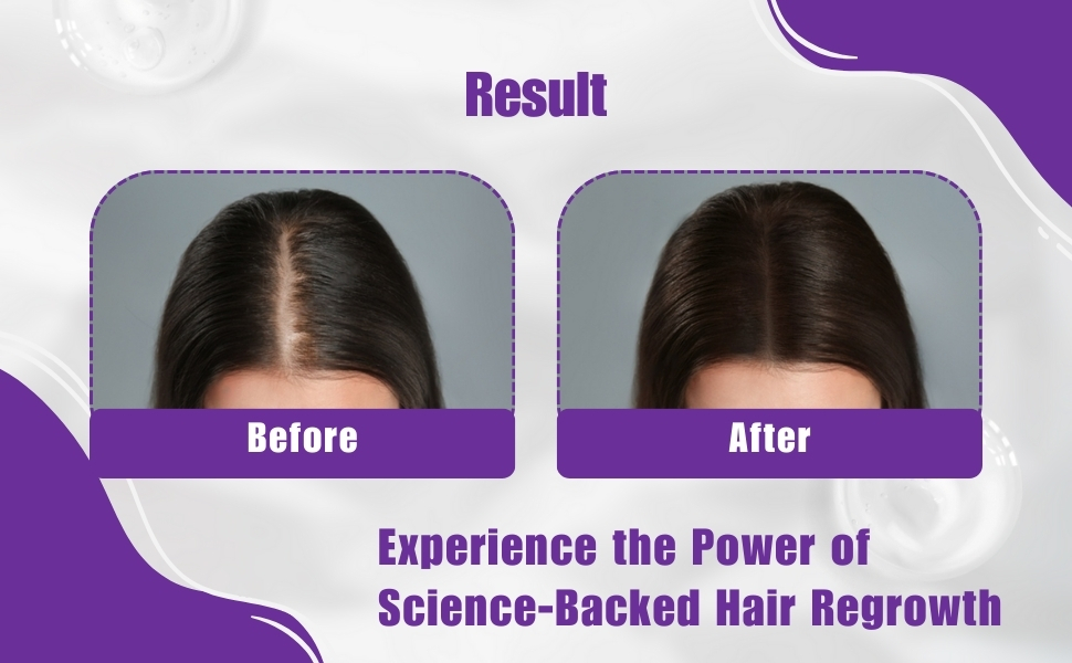 Anti-Hair Loss Shampoo