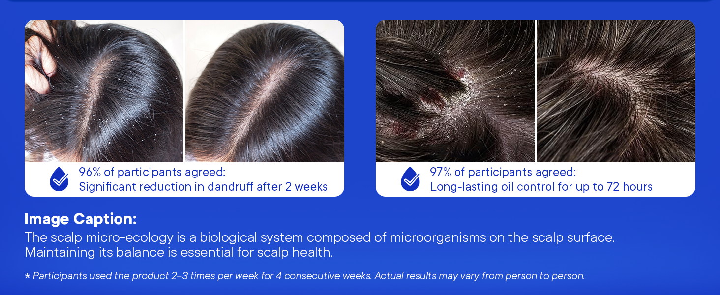 ProBliva Medicated Anti-Fungal Shampoo