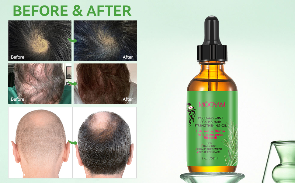 rosemary oil for hair growth organic hair oil hair growth products hair growth oil 