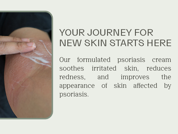 Crema para Eczema, Effective Skin Cream, Soothing Care for Irritated Skin