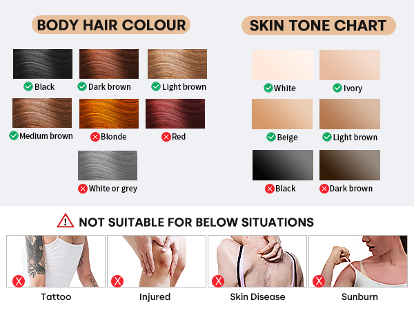 laser hair removal