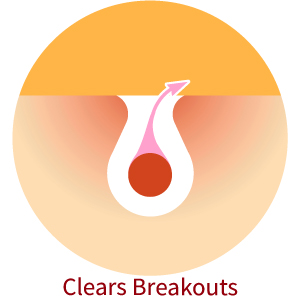 Clears Breakouts