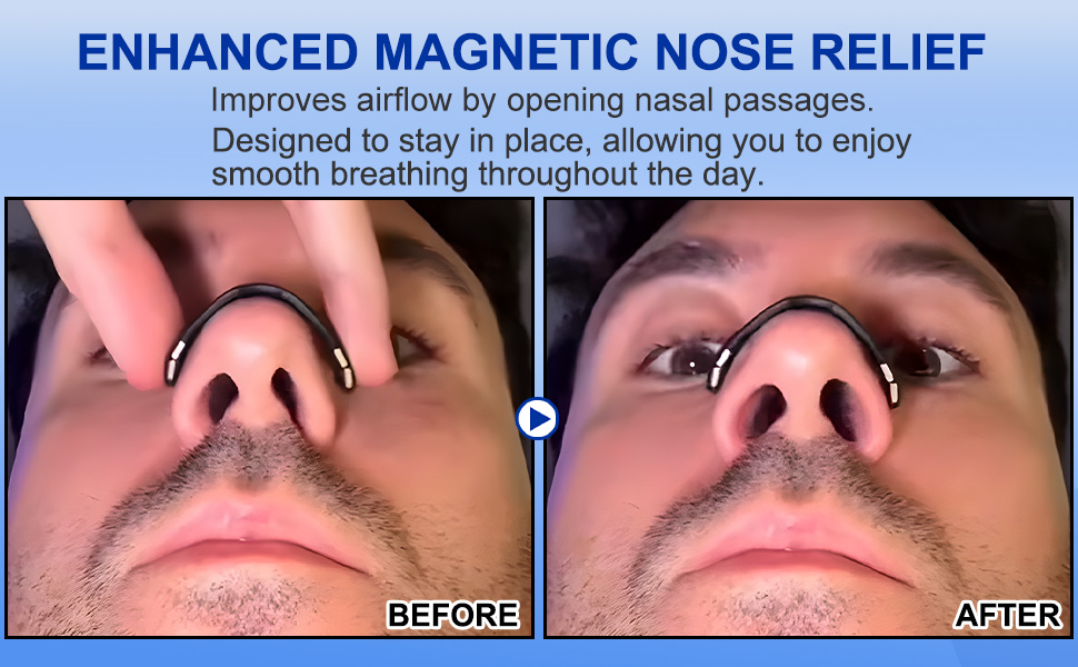 Nose Strips