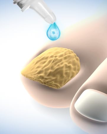 closeup of nail with applicator tip