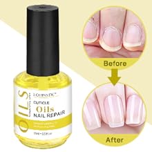 gel remover