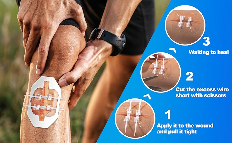 suture removal kit,zipstitch,Zipstitch Laceration Closure Kit for Cut Care,RHINO RESCUE,nexcare,