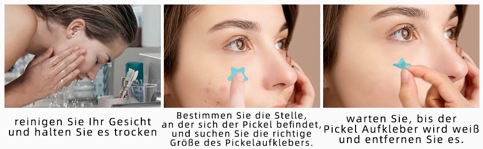 ster acne patch