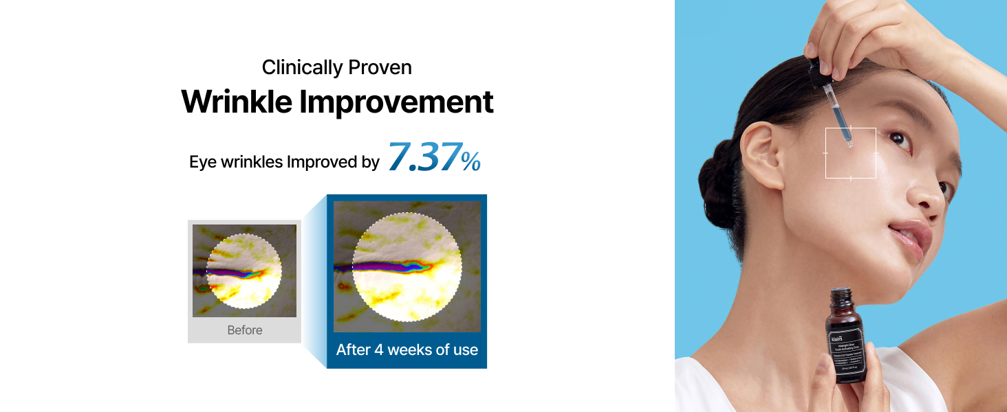 Anti-aging serum, wrinkle care, EGF peptide, clinical test, before after, eye wrinkle solution