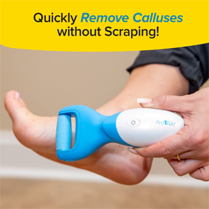 Quick & Easy Way to Remove Calluses