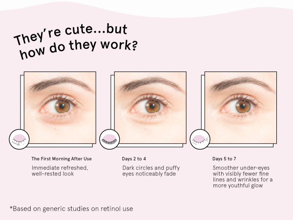 Say goodbye to puffy eyes! Our gold under eye patches with before and after model comparison