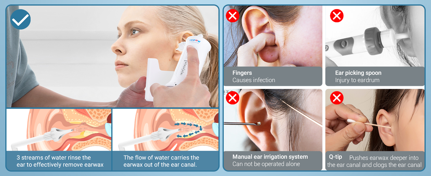 ear wax removal kit