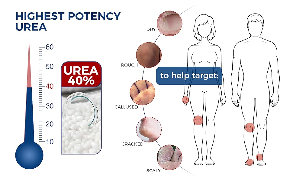 Urea Cream