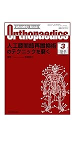 インプラント周囲骨折を極める 馬場智規 インプラント周囲骨折を極める | 馬場智規 |本 | 通販 | Amazon