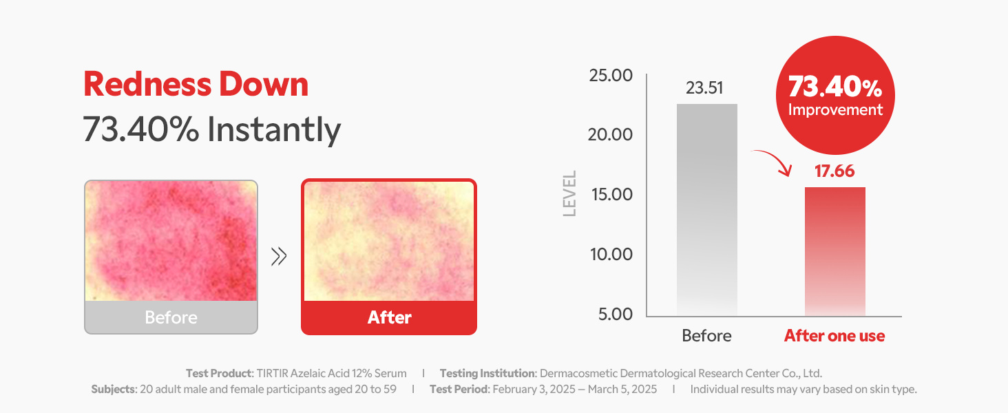 Azelaic Serum