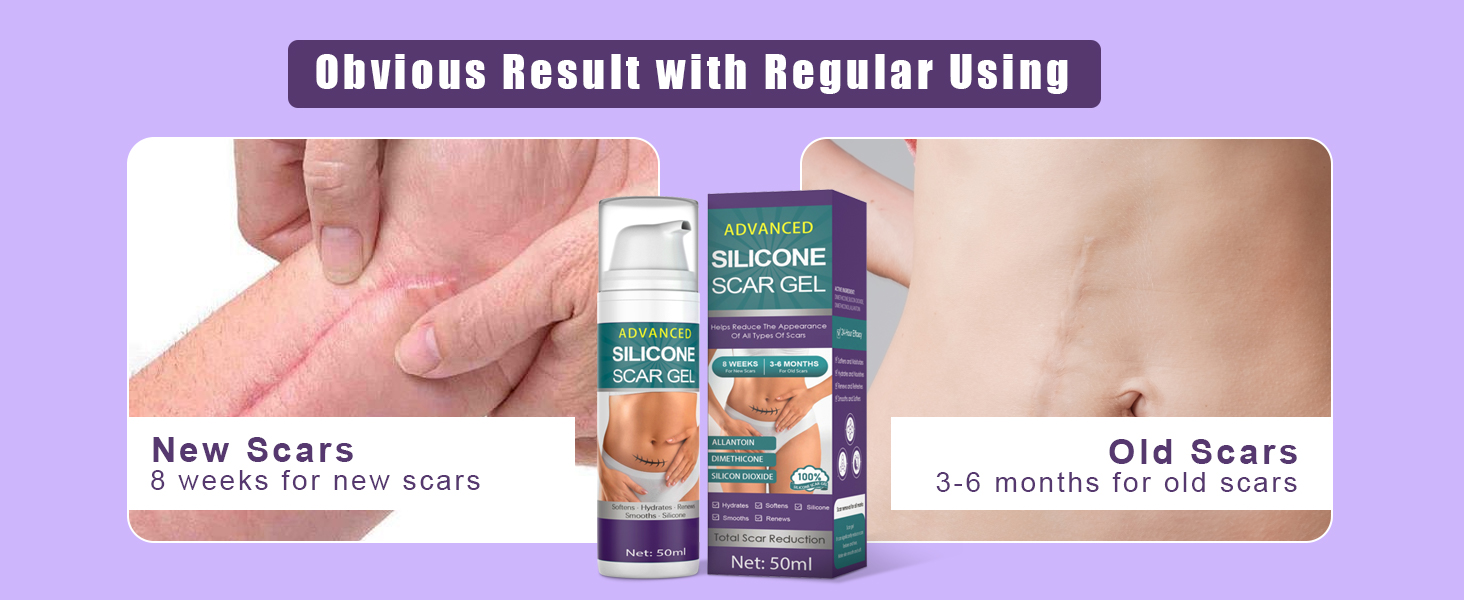 silicone scar cream