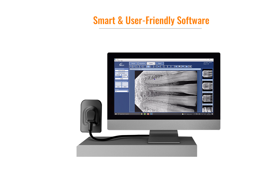 Waldent Carpo RVG VSensor Dental RVG Sensor For High Resolution