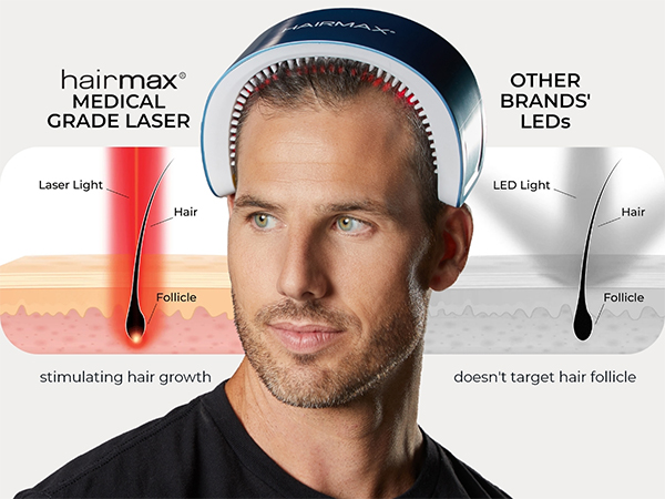 hair growth laser devices