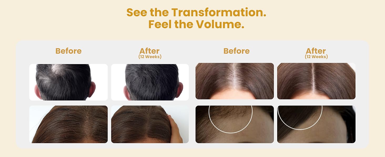 suero capilar para el crecimiento del cabello bar peptide nulastin aparty balding capilar gorgeous