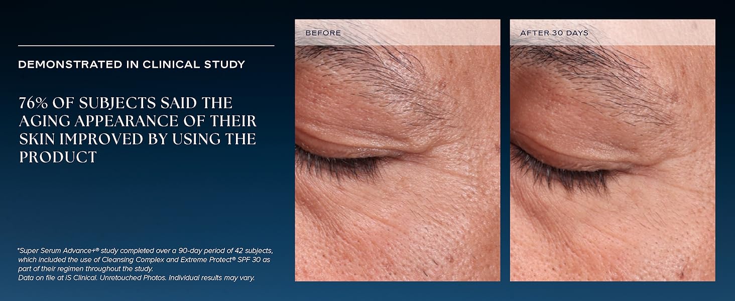 76% of subjects said the aging appearance of thier skin improved