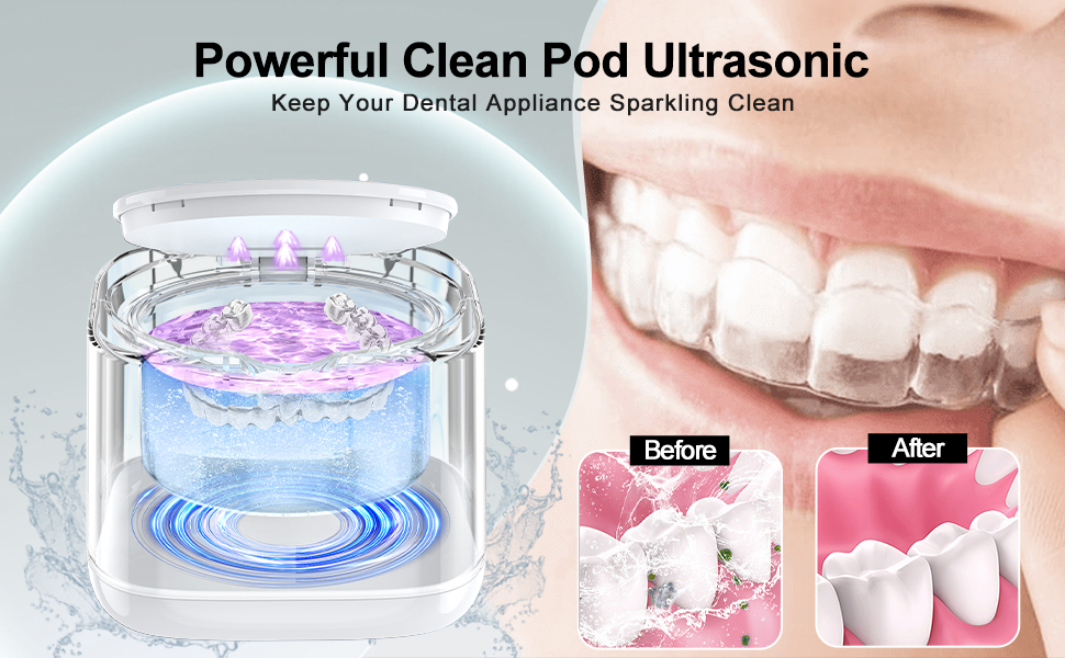 Ultrasonic Cleaner, Cordless UV Ultrasonic Retainer Cleaner Machine, 45KHz 180ML