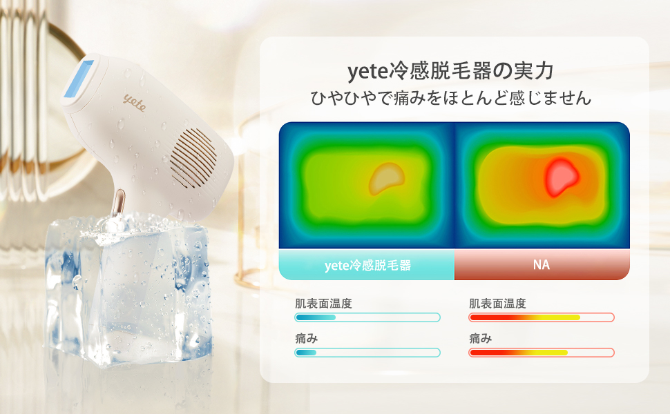 Amazon | yete 脱毛器 冷感脱毛器 光脱毛器 家庭用脱毛器