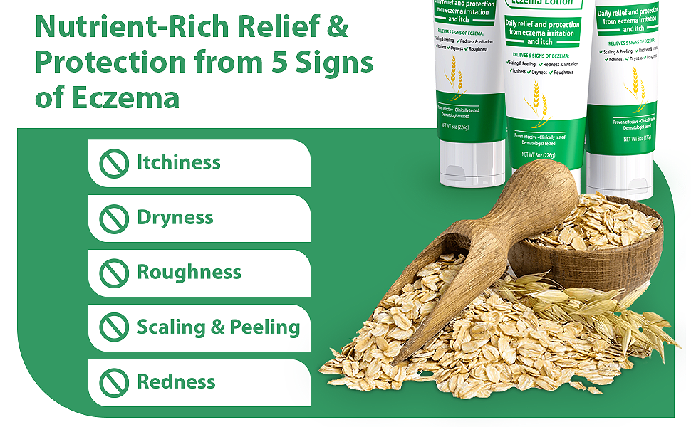 eczema lotion eczema cream for adults eczema cream eczema hand cream