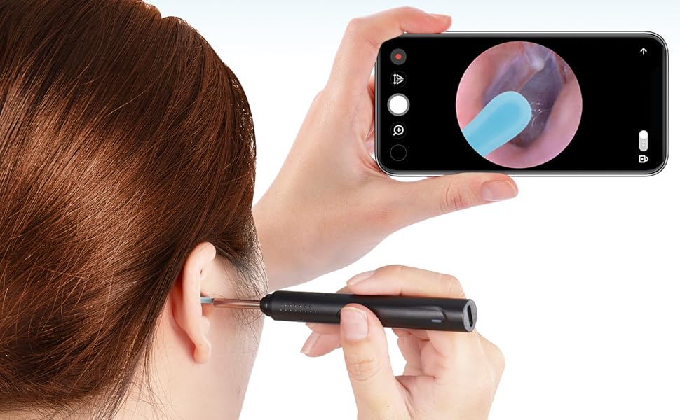 earwax removal tools with camera