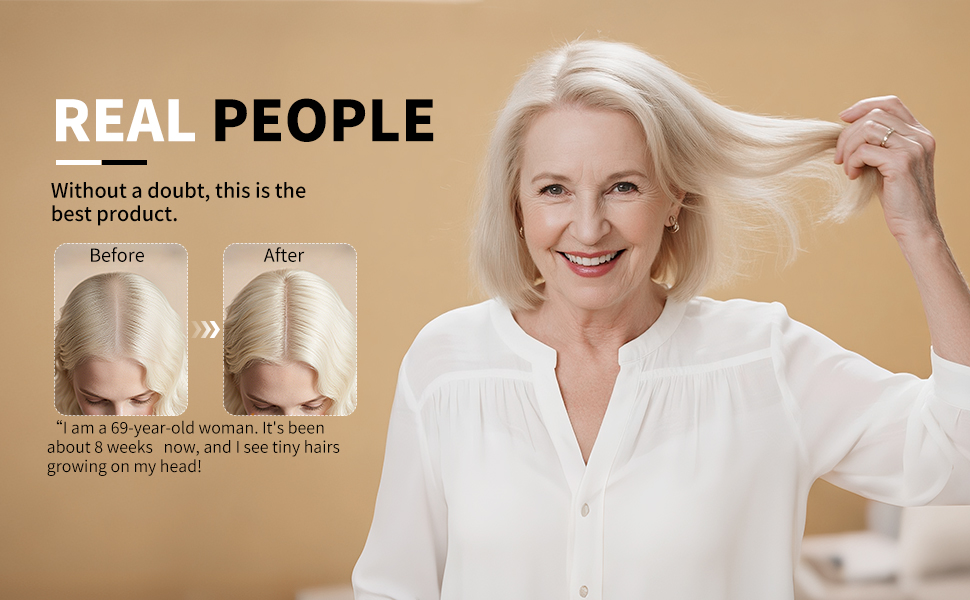 Minoxidil for men and women