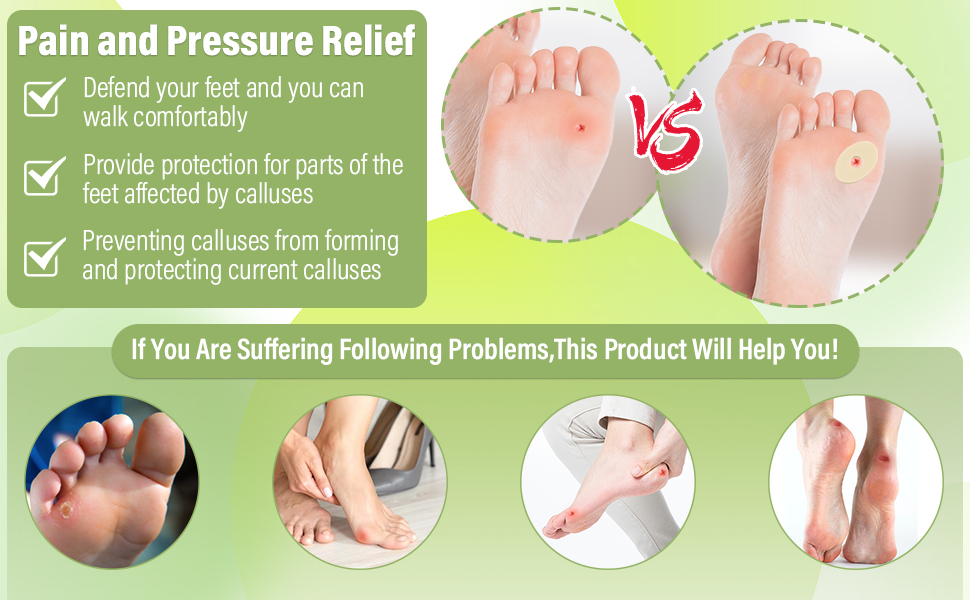 Callus Cushions Callus Pads for Bottom of Foot