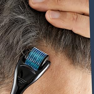 avec aiguilles bleues utilisé sur le cuir chevelu, les doigts visibles guidant