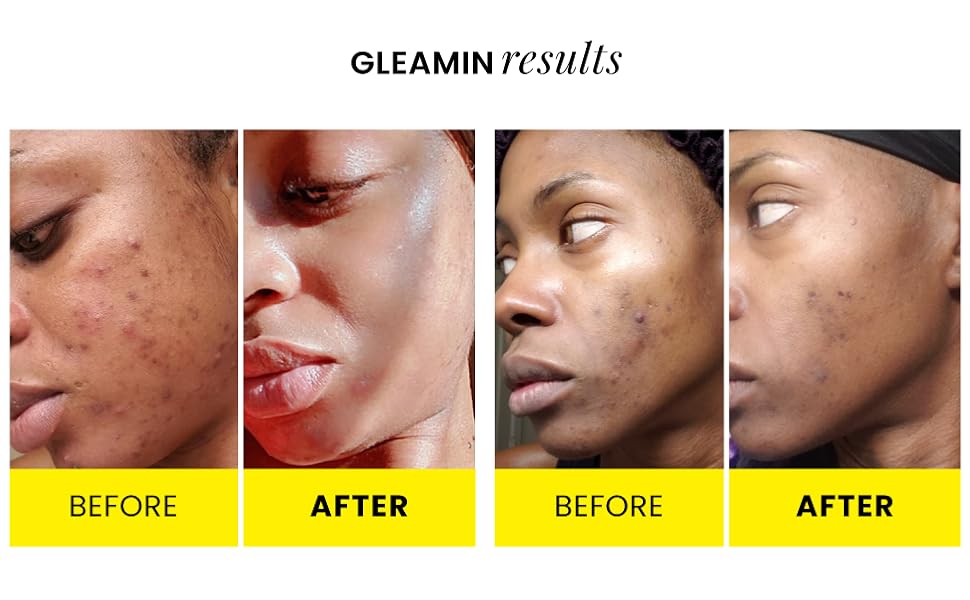 Gleamin Turmeric Vitamin C Clay Mask & Mask Brush Clay Face Mask with Aloe