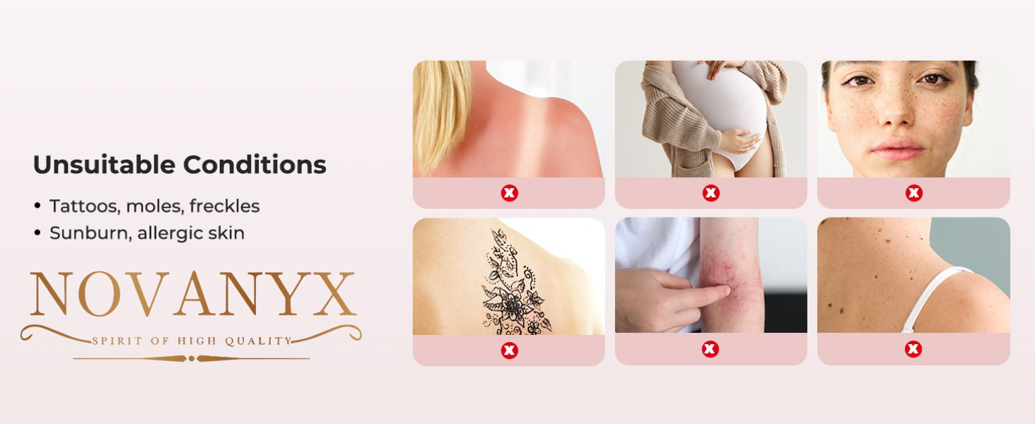 ipl laser hair removal