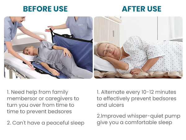 air pressure mattress for bed sores