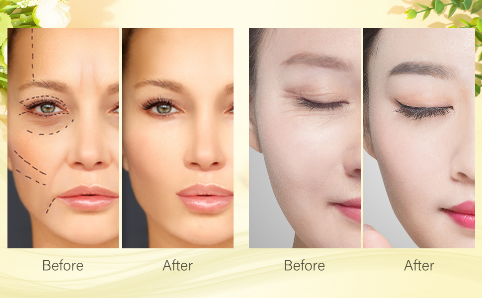 under eye gel patches