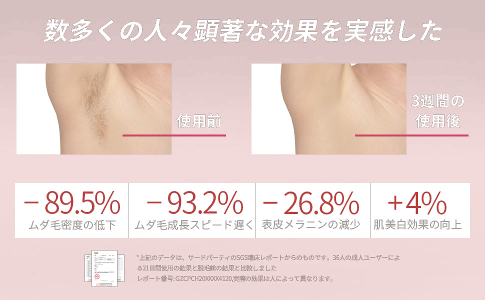 AISLE 脱毛器 2022最新ドイツ 光学技術 サファイア 冷感脱毛器 軽量 Amazon | AISLE 脱毛器 2022最新ドイツ 光学技術 サファイア 冷