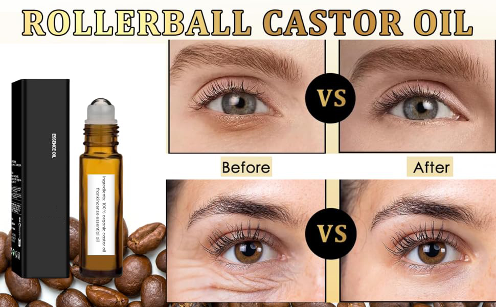 2Pcs Roller Ball Castor Oil, Castor Oil Frankincense Rollerball, for Eyes, Bags Under Eyes