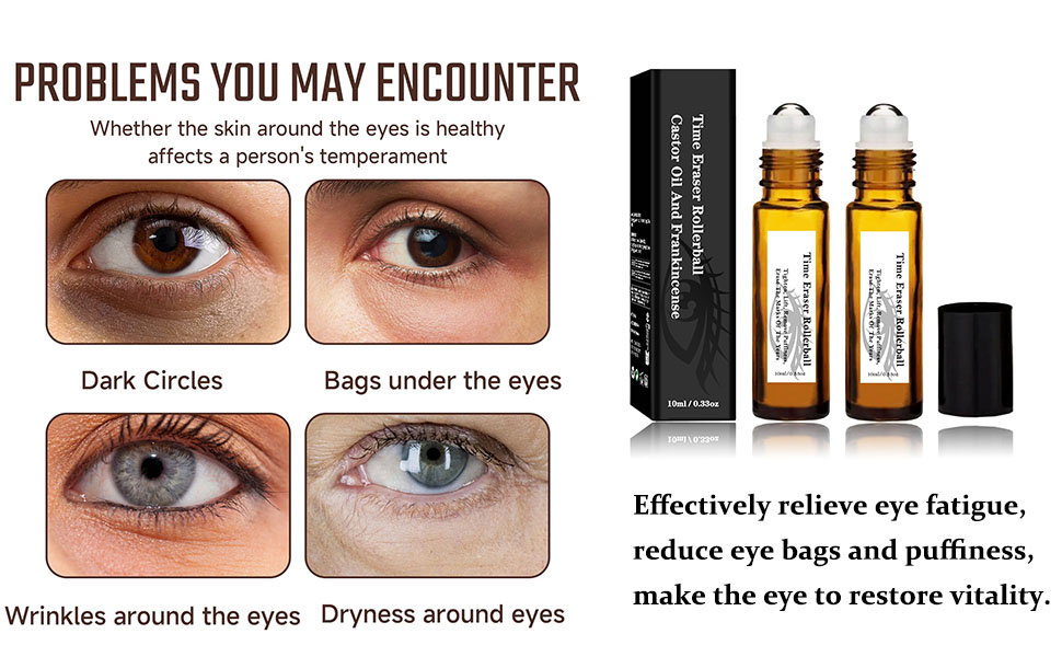 2Pcs Roller Ball Castor Oil, Castor Oil Frankincense Rollerball, for Eyes, Bags Under Eyes