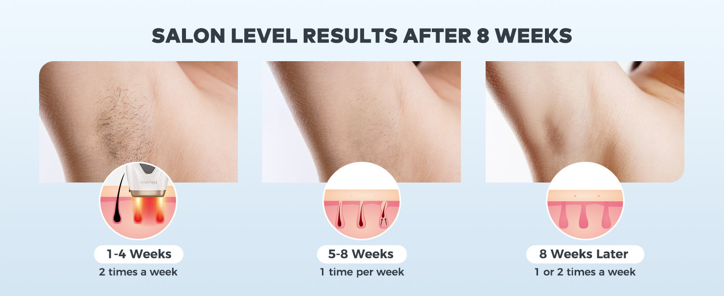 facial hair remover for women. Visible changes in 4 weeks, with long-lasting results in 8 weeks.
