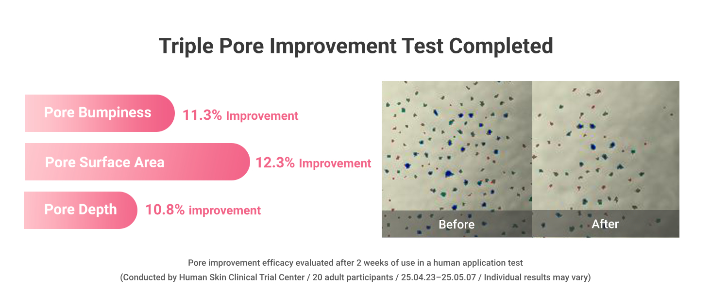 PORE