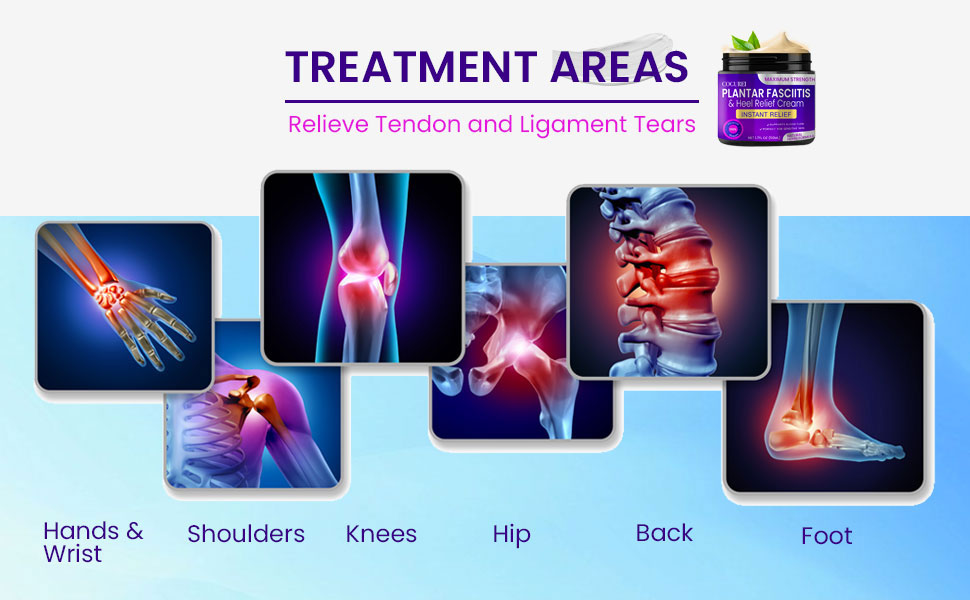 Plantar Fasciitis Treatment