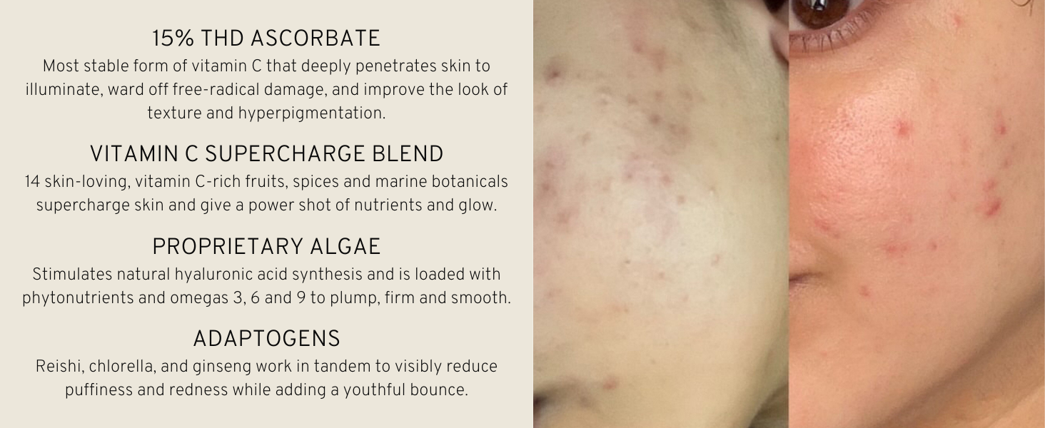 Key Ingredients: THD Ascorbate, Vitamin C Blend, Proprietary Algae, and Adaptogens.