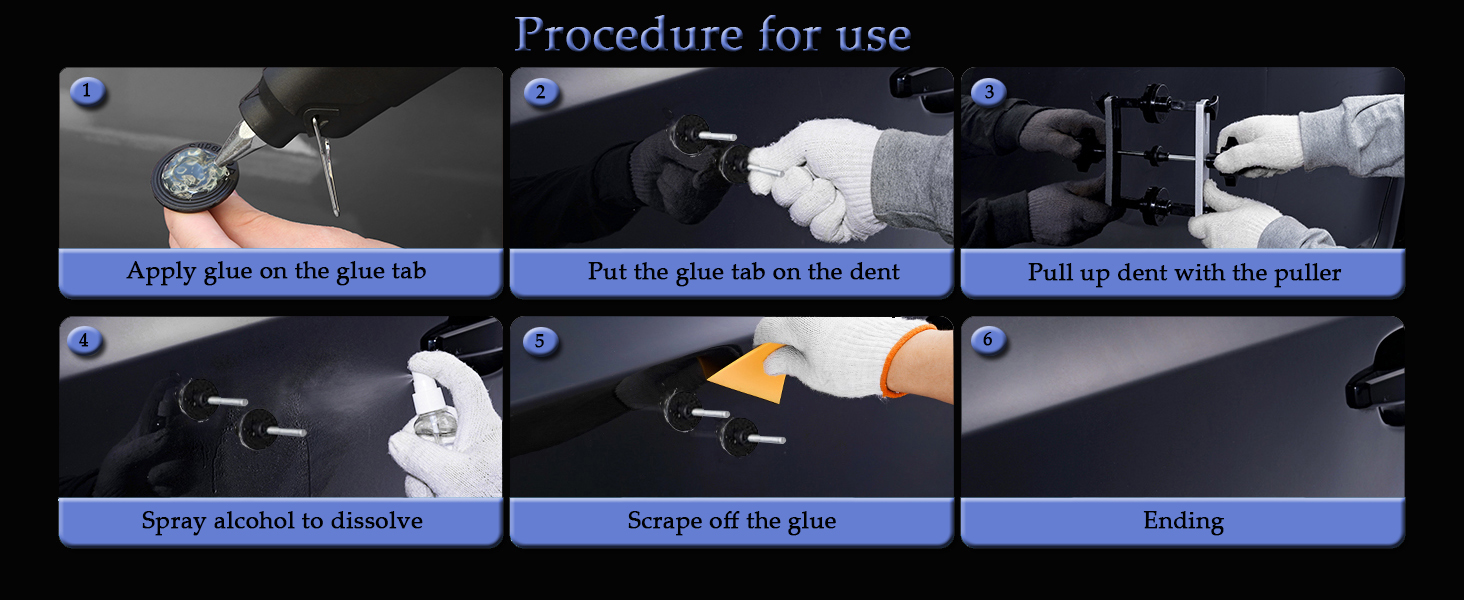 Usage of Bridge Dent