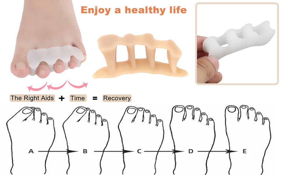 Amazon.com: 3 Pairs Toe Spacers to Correct Toes Soft Gel Toe Separators ...