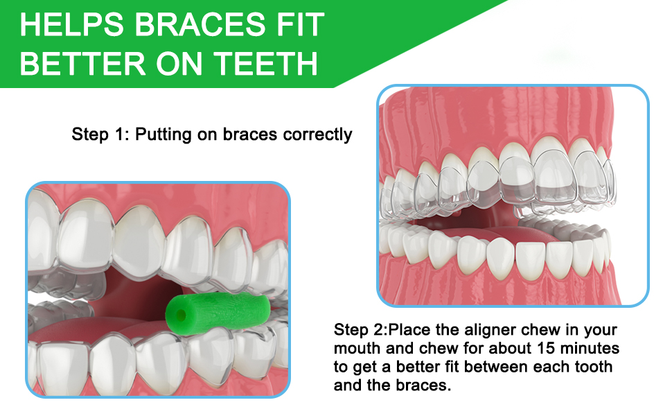 30 PCS Aligners Chewies, Retainer Chewies, Chewies Aligner