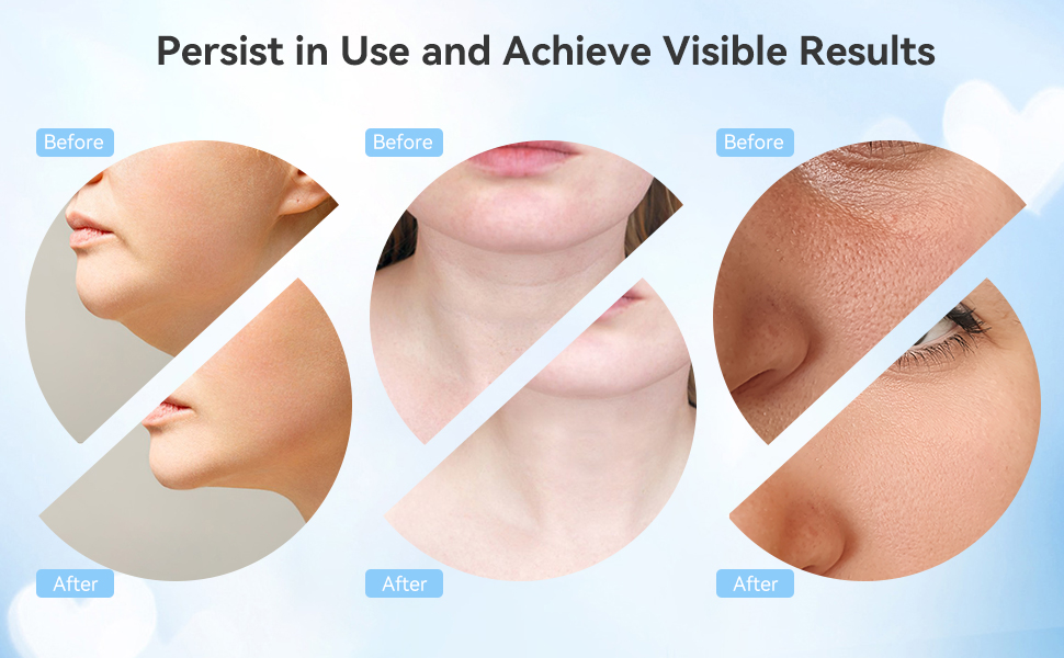 true beauty glow; face massager electric; red light therapy hair; face massage tool