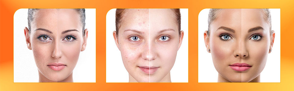Vitamin C cream for face